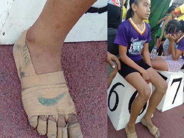 붕대로 만든 '나이키' 신발 신고 금메달 딴 필리핀 11살 육상선수