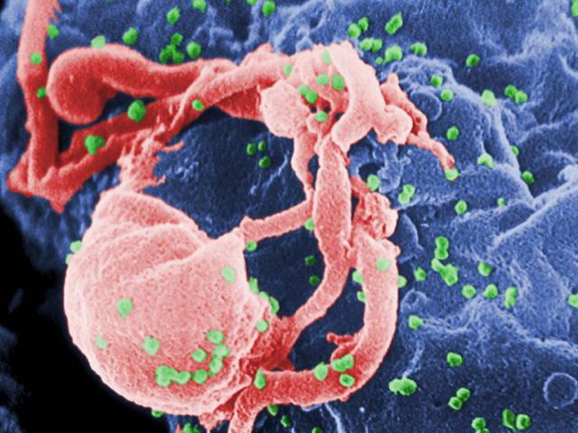 ‘슈퍼 면역력’으로 에이즈 자연 치유…기적의 완치자 발견