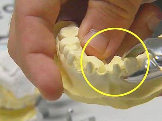 과잉치료 폭로했던 치과의사가 눈뜨고 당하기 쉽다는 이 치료는?