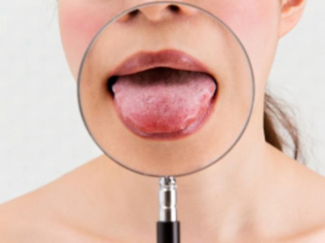 ‘혀’로 보는 건강상태 9가지