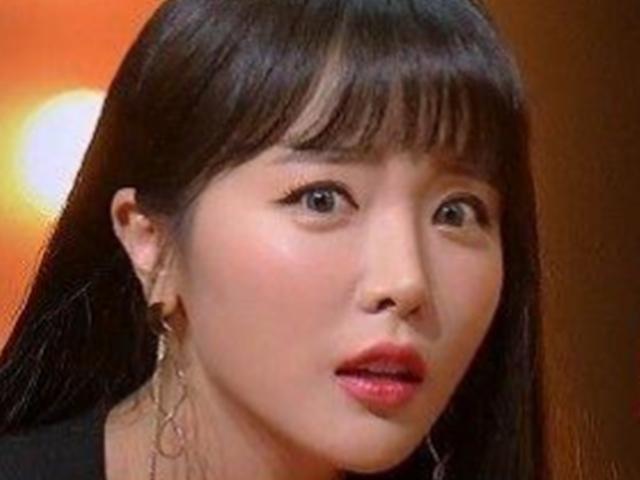 홍진영, <strong>성형</strong> <strong>고백</strong> “쌍꺼풀 수술? 달라진 건 코”