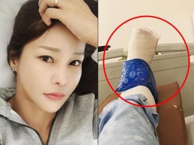 <strong>미나</strong>, 골절 사고에도 공연 강행 "수술 예정 걷지도 못해"