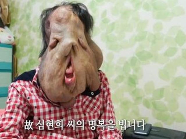 '세상에 이런일이' 심현희 씨 사망..."재활수술 도중 불의의 부상 당해"