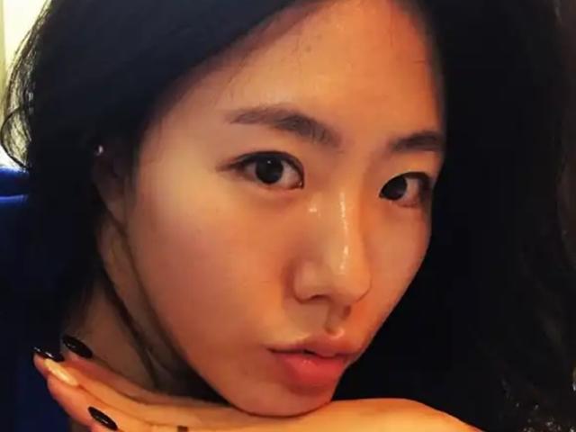 <strong>이상화</strong> 성형 어디?