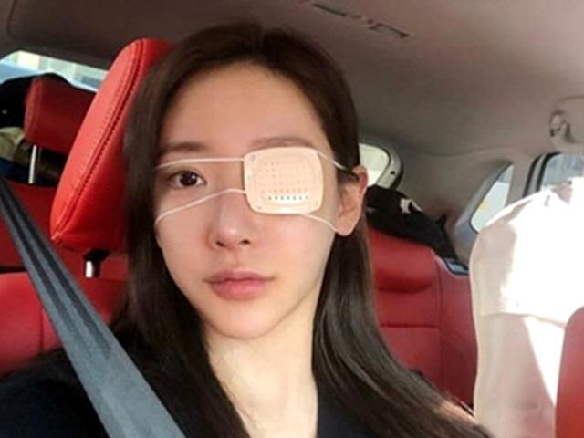 송다예, 얼굴 피멍 <strong>해명</strong> "김상혁이 때린게 아니라 계단에서 구른 것"