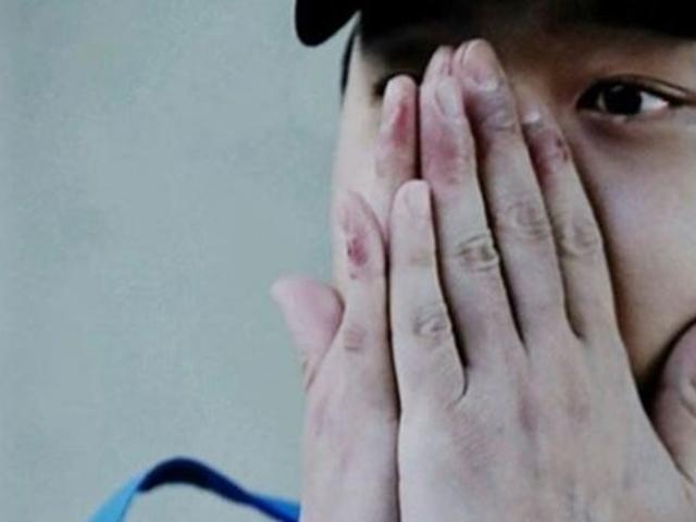 '<strong>마약</strong> 투약' 박유천, 다리·손 상처 재조명…메스버그 현상 '의혹'