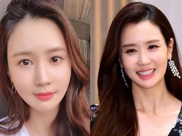 이다해 소속사 "성형 의혹? 컨디션 따라 달라보이는 것" [<strong>공식입장</strong>]