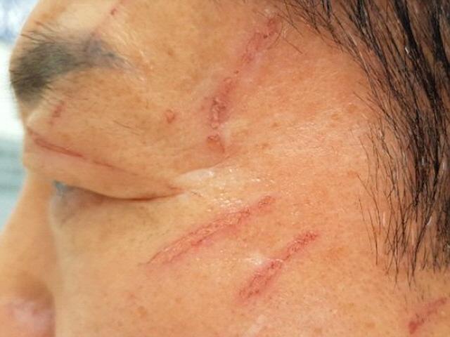[단독]“딸 같은 매니저 위기 보고 그냥 몸 던져”… 패스트푸드점 <strong>난동</strong>범 제압한 60대