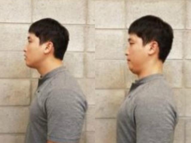 <strong>거북목</strong> 걱정되나요? 가장 먼저 할 일은 가슴스트레칭