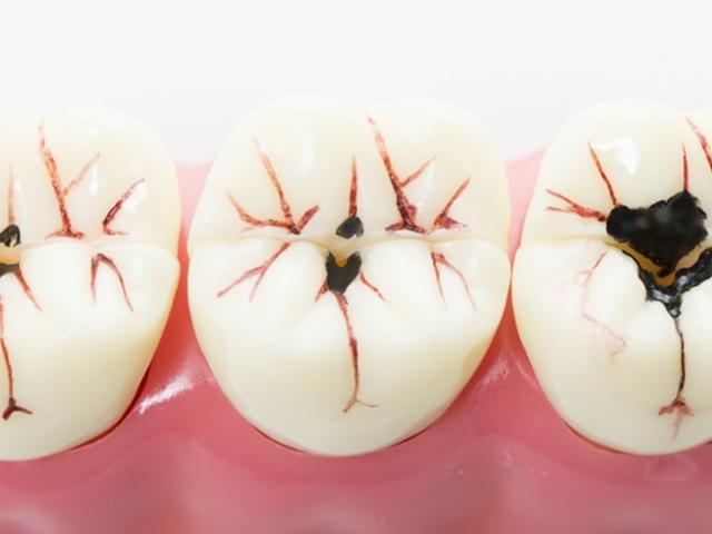 치과, 가깝다는 이유로 치료받다간 ‘호갱’