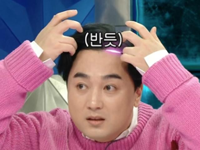 <strong>황제성</strong> "최근 모발이식 수술…산 채로 눈알 뽑히는 느낌"