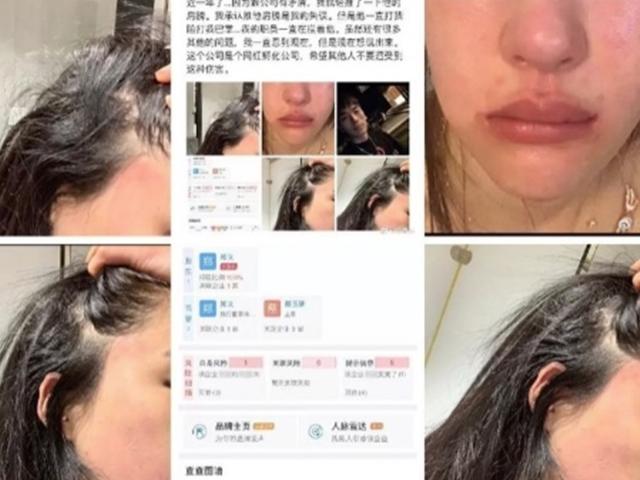 "소속사 사장에게 맞았습니다"...<strong>모델</strong> <strong>반서진</strong> 충격적인 주장