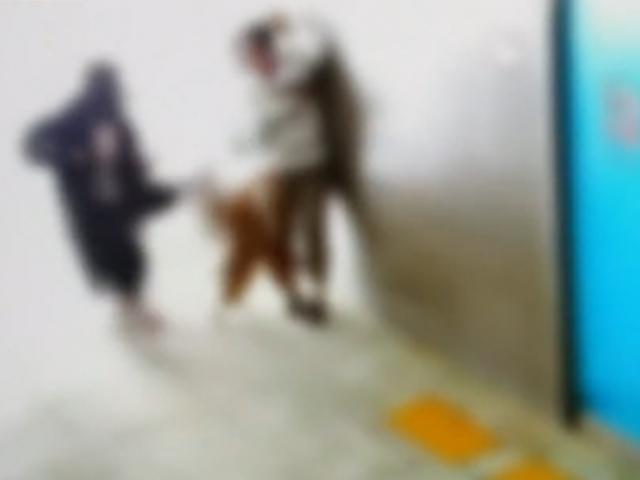 "또 <strong>입마개</strong> 없었다" 불도그 2마리 달려들어...'개물림 사고' CCTV 영상 공개