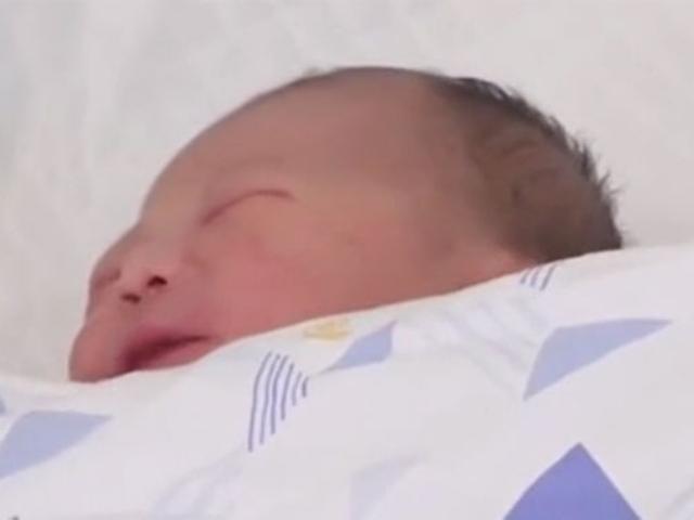 목에 탯줄 6바퀴 칭칭 감고도 살아서 태어난 ‘기적의 아기’