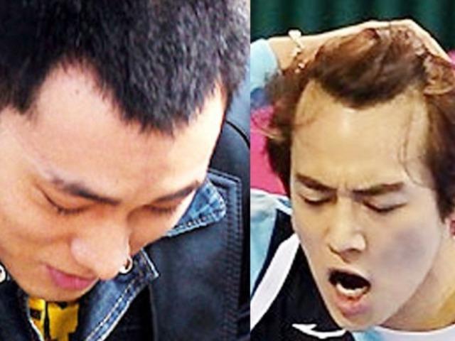 의사도 “정말 이식하길 잘했다”고 인정한 다른 얼굴된 연예인