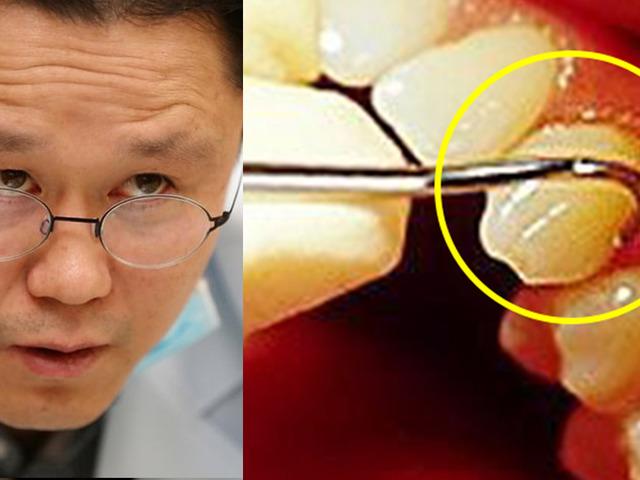 “모르면 당한다” 양심 <strong>치과</strong>의사가 유독 조심하라고 경고한 치료