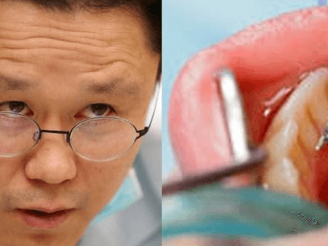 “모르면 당한다” 양심 <strong>치과</strong>의사가 유독 조심하라고 경고한 치료
