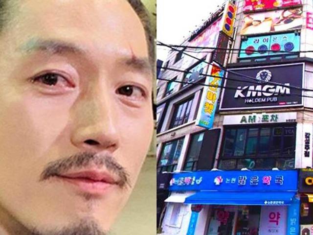 6년전 155억 주고 구입한 장혁의 논현동 빌딩, 지금 시세가?