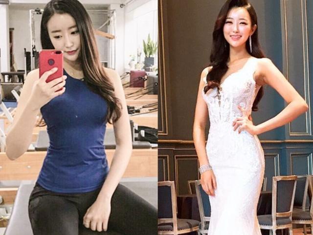 잘 웃던 그녀가 <strong>엑스</strong>레이 사진 보고 절망한 이유