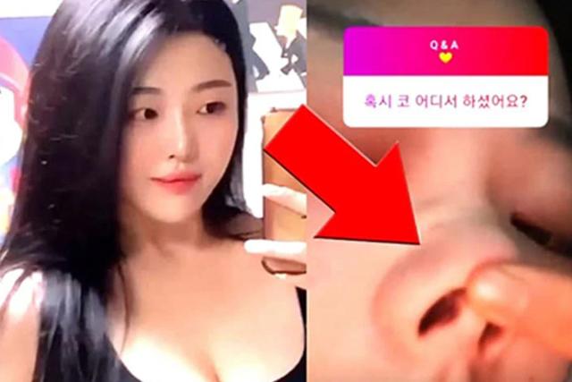 “성형한 거 아니냐?” 도 넘은 악플에 연예인 딸, 셀카와 함께 이런 일침 날렸다