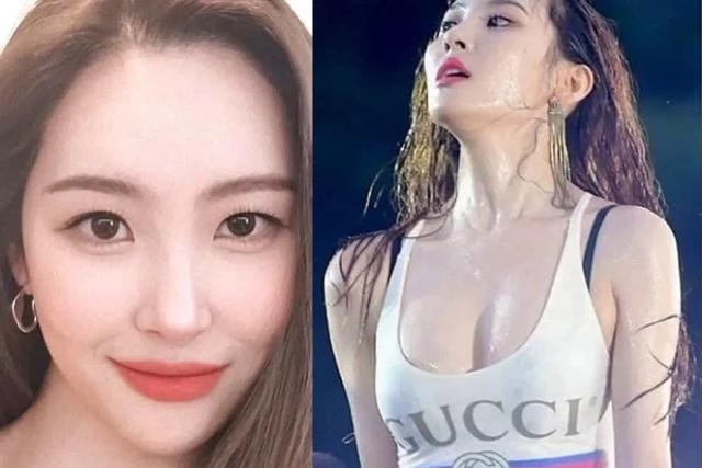 “혹시 가슴 수술한 거 아니에요?” 성형 의혹에 선미가 한 대답