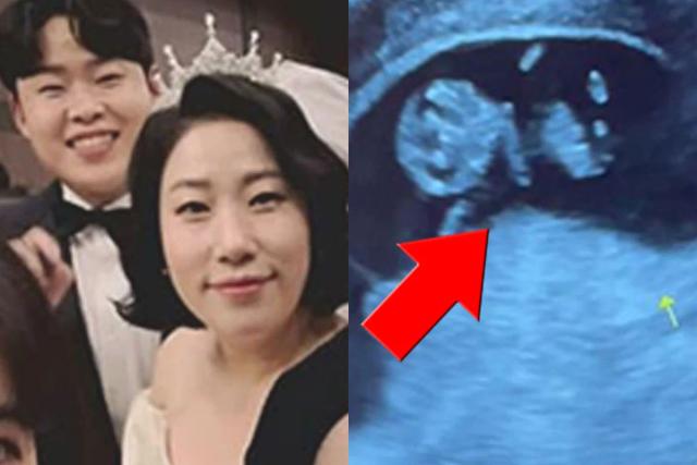 “백신 부작용인줄알고 병원갔는데…” 잠잠하던 여자개그맨이 전한 반가운 소식