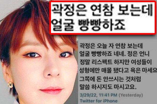 “얼굴 빵빵하다” 보톡스 의혹받은 곽정은, 이렇게 해명했다