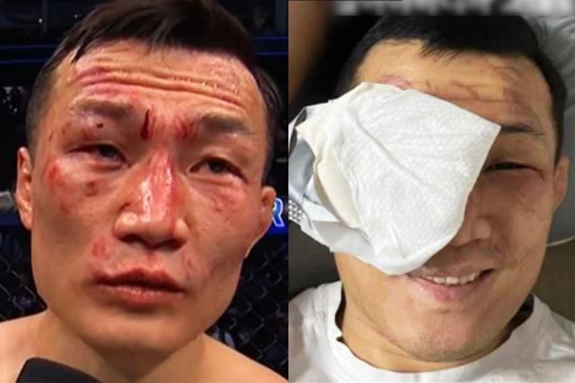 ‘코리안 <strong>좀비</strong>’라 불리던 정찬성, 은퇴 암시 후 가슴 아픈 사진 공개했다