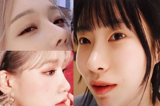 성형으로 대박난 개그우먼, 병원에 사진 들고 갔다는 걸그룹 멤버 정체