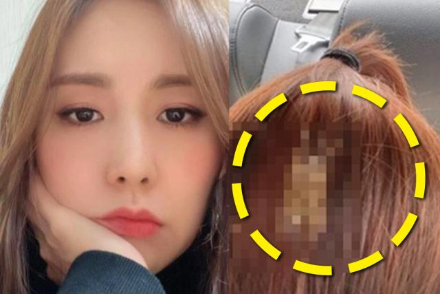 ‘머리에…’ 여가수가 공개한 충격적인 사진에 모두가 놀란 이유는 이렇다