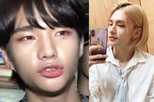 <strong>학폭 논란</strong>으로 자숙했던 아이돌 멤버, 5개월 만에 모습 드러냈다
