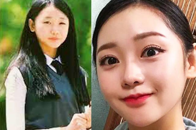 <strong>성형수술</strong> 2번 했다 직접 고백한 트로트 가수, 이런 말까지 했다