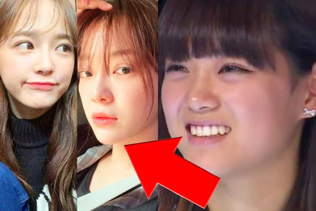 성형 수술 악플에 ‘자작글’ 썼던 아이돌 출신 여배우, 직접 입 열었다