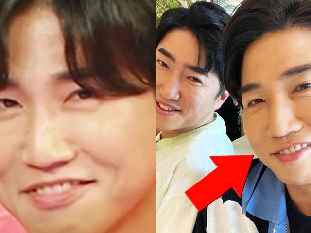 시술 후 달라진 모습에 ‘안영미’마저 “잘생겼다” 인정한 개그맨