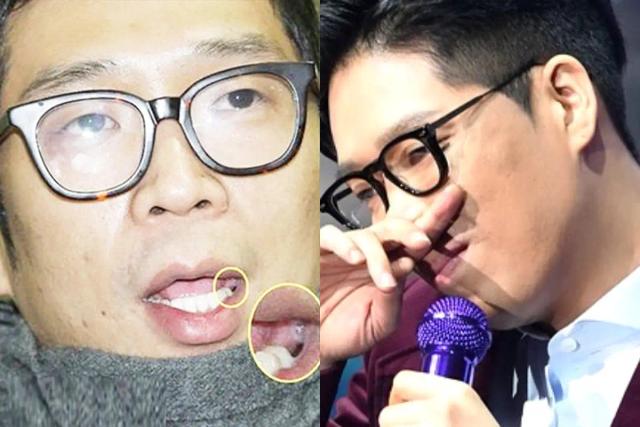 발치 논란에 <strong>연예계</strong> 떠났던 가수, 뜻밖의 근황에 <strong>반응</strong> 엇갈렸다