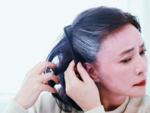 엄마 피부에 이상한 검버섯…나이 탓만 하다간, <strong>암</strong> 키운다