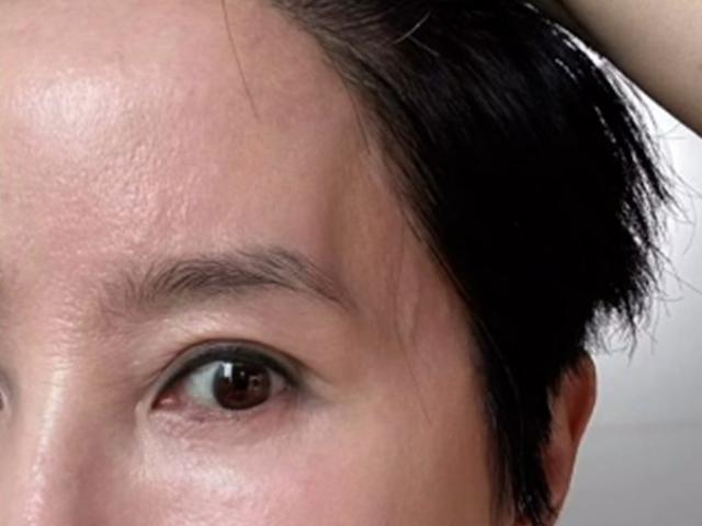 "얼굴 함몰돼...무서워" 박혜경, 자고 일어났더니 이마 움푹 무슨 일?