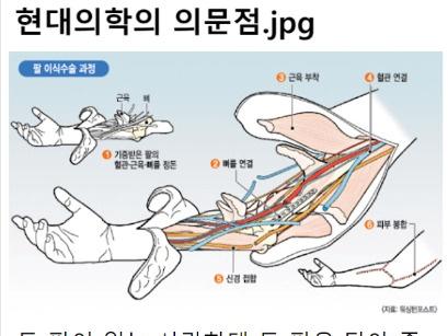 머리를 통째로 이식하는 수술까지도 성공한 현대 <strong>의학</strong>이 손도 못대고 있는 영역