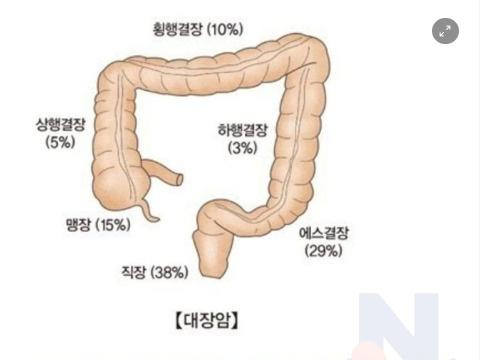 <strong>의사</strong>들이 말하는 대장암 환자의 공통 생활 습관