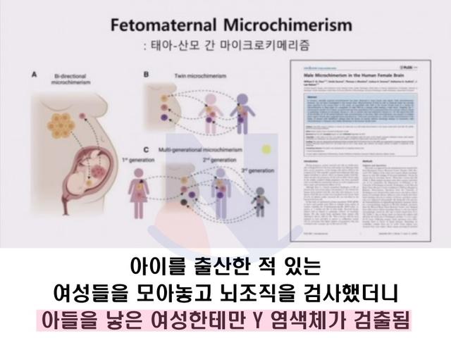 아들 낳은 엄마 뇌가 남자처럼 변해버리는... <strong>과학</strong>적 이유 밝혀짐