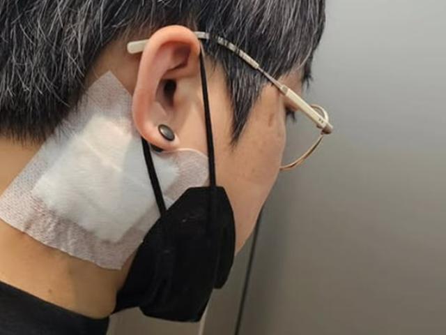 원타임 송백경, 온몸에 붕대 감은 근황…"연예인병 흔적 제거 시작"