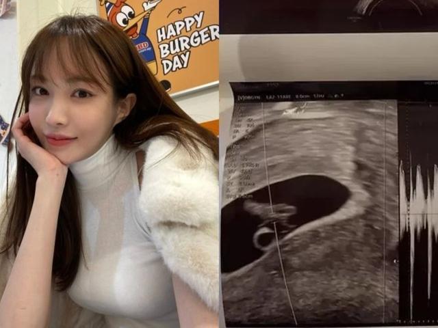 ‘임신사실’ 고백한 뒤 남친 신상 폭로한 서민재... “아이에 부끄럽지 않게 살 것”