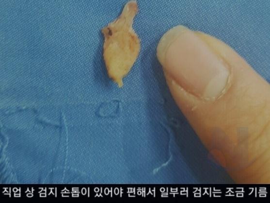 많은 의사들<strong>이</strong> 포기한 불치병 치료했다;;