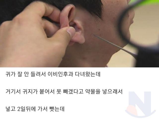 <strong>병원</strong>에서 귀지 뺀 후기..