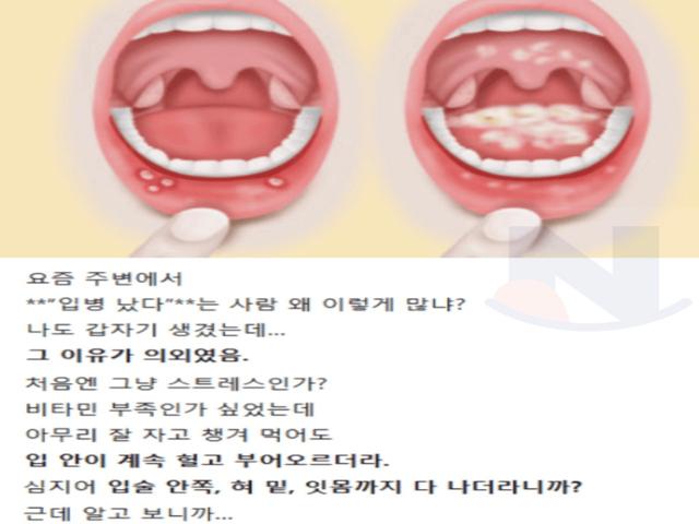 요즘 입<strong>병</strong> 난다는 사람들이 많아진 진짜 이유..