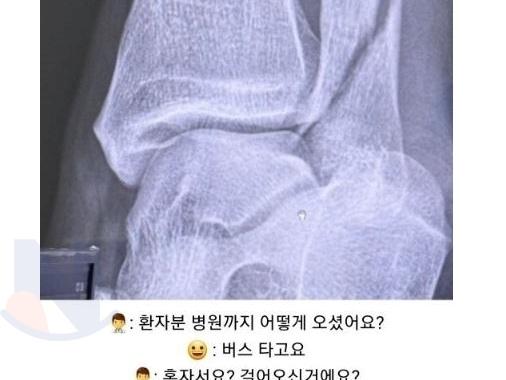 발목 부러졌는데 하나도 <strong>안</strong>아프다는 여자의 11개월 뒤..