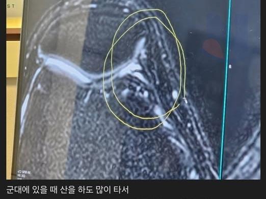<strong>무릎</strong>내주고 초능력 얻은 익붕이 ㄷㄷㄷ