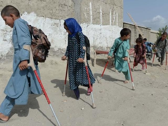 [서소문사진관]전쟁을 멈춰주세요. 아프칸 어린이에게 남은 전쟁의 상흔