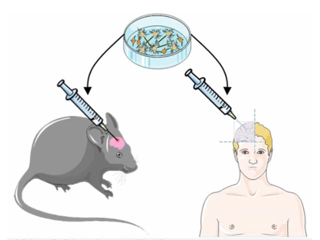 인간의 뇌세포→쥐의 뇌에 이식… ‘뇌 바꾸기’ 성공