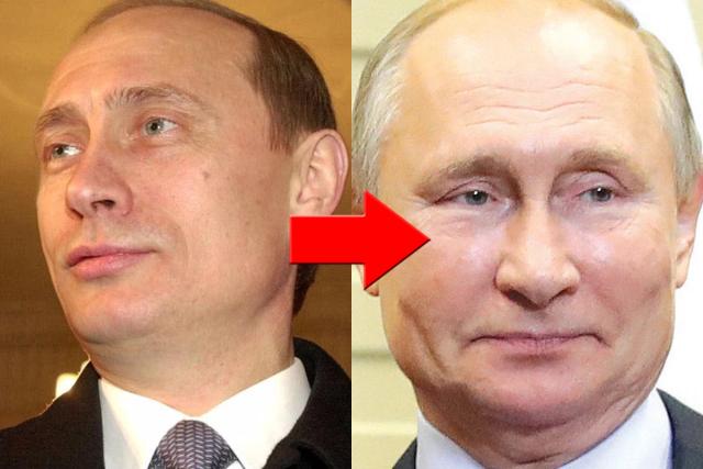 “얼굴이…” 푸틴도 ‘약물 사용’했다고 의심되는 정황이 지금 밝혀지고 있다